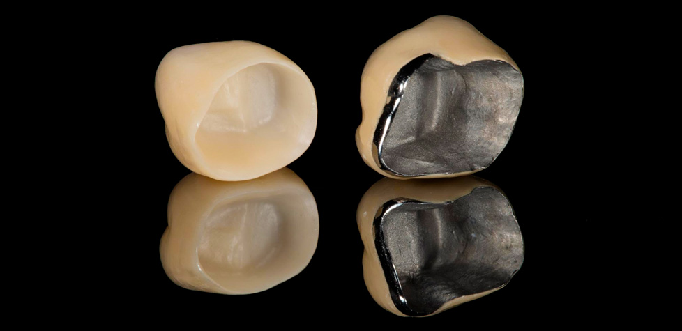 O ensaio de compatibilidade em restaurações dentárias